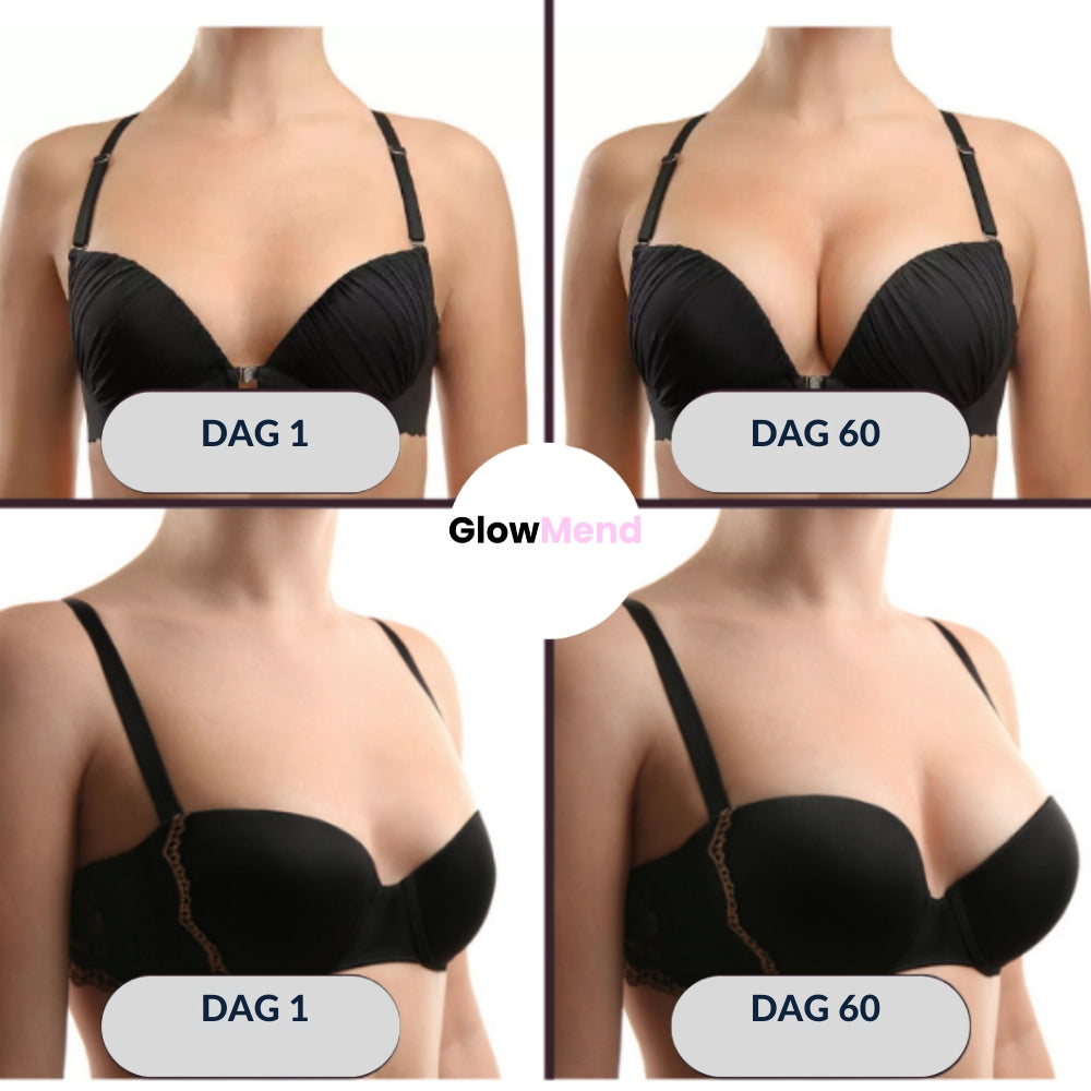 GlowMend - Borstvergrotende patch